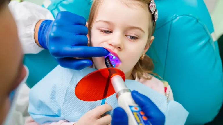 Child receiving dental sealant treatment with curing light